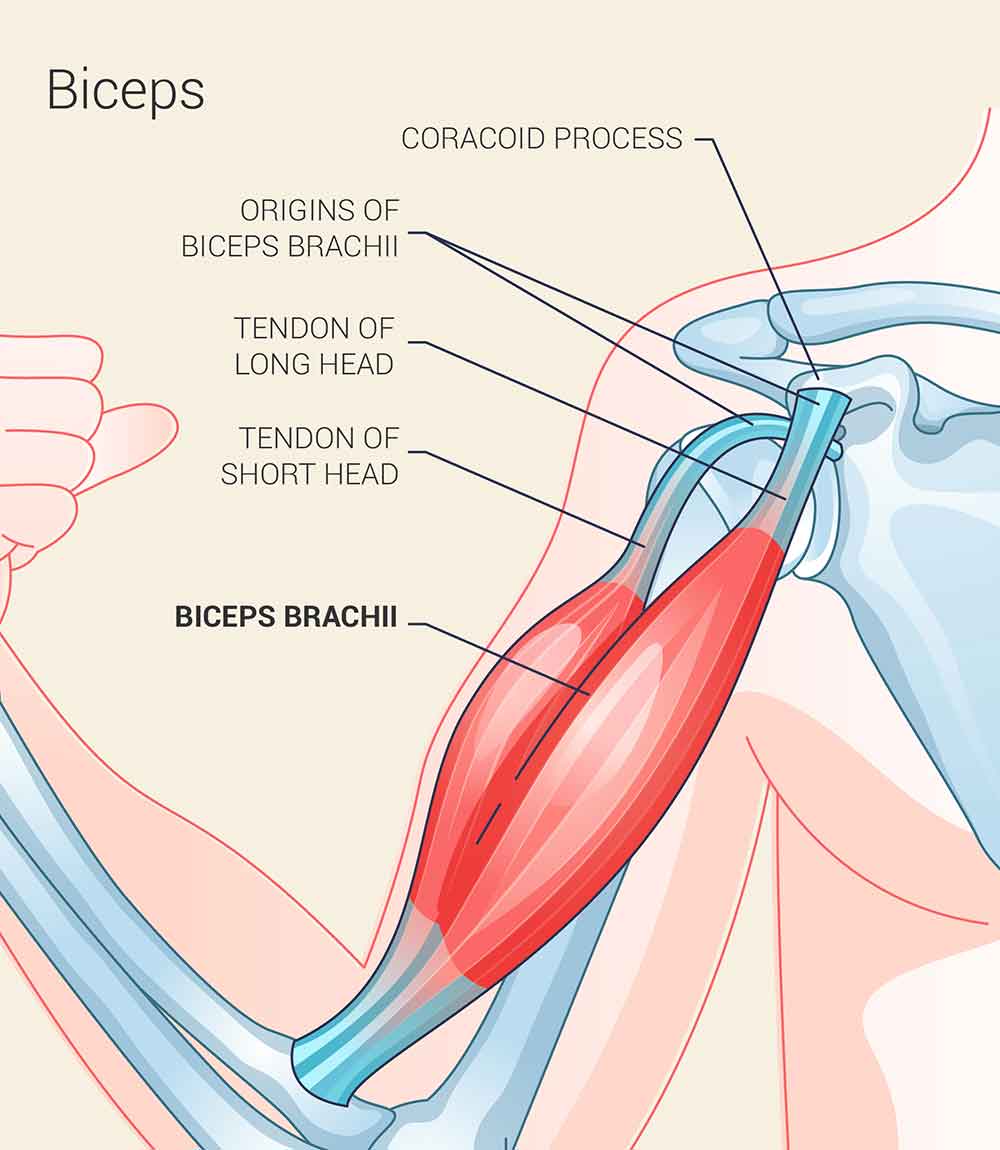 Biceps tendon rupture treatment