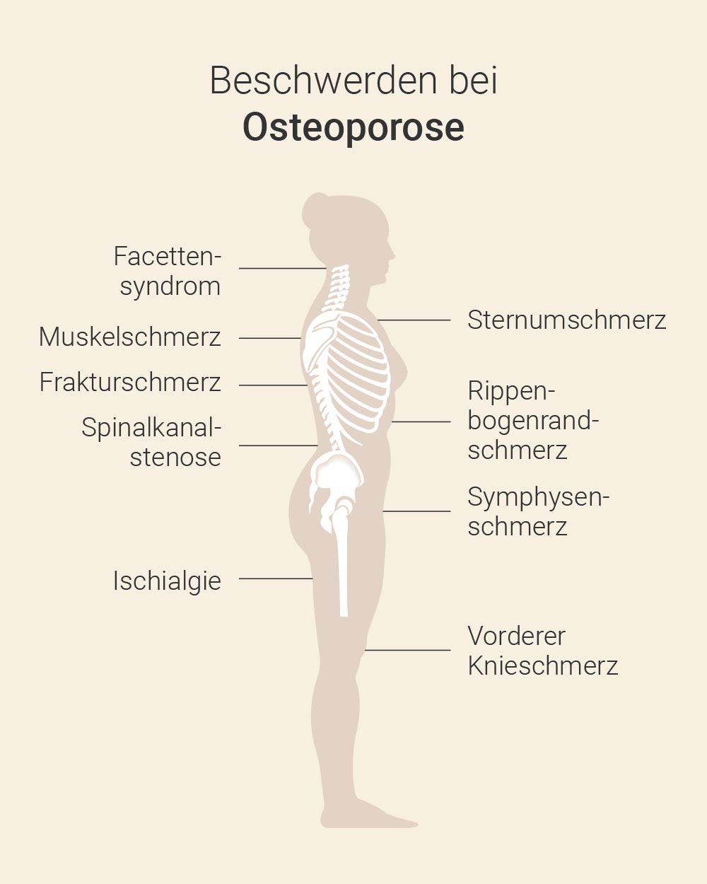 Osteoporose Symptome