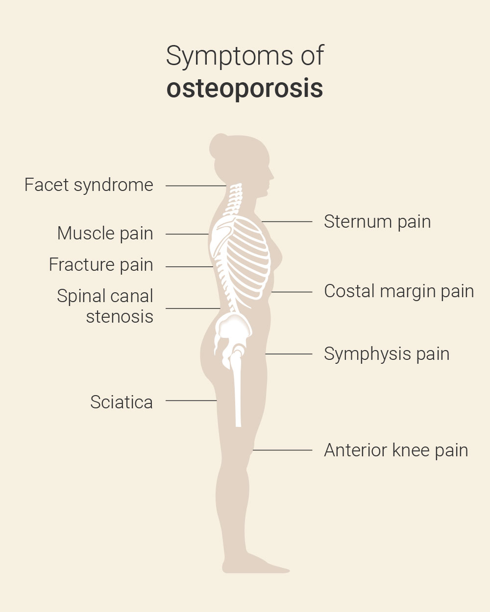 Osteoporosis Frankfurt | Osteoporose symptoms