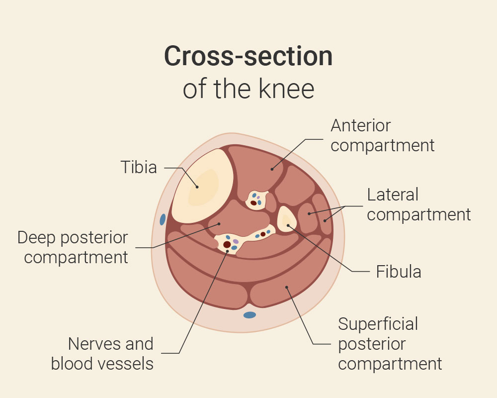 Osteoarthritis of the knee